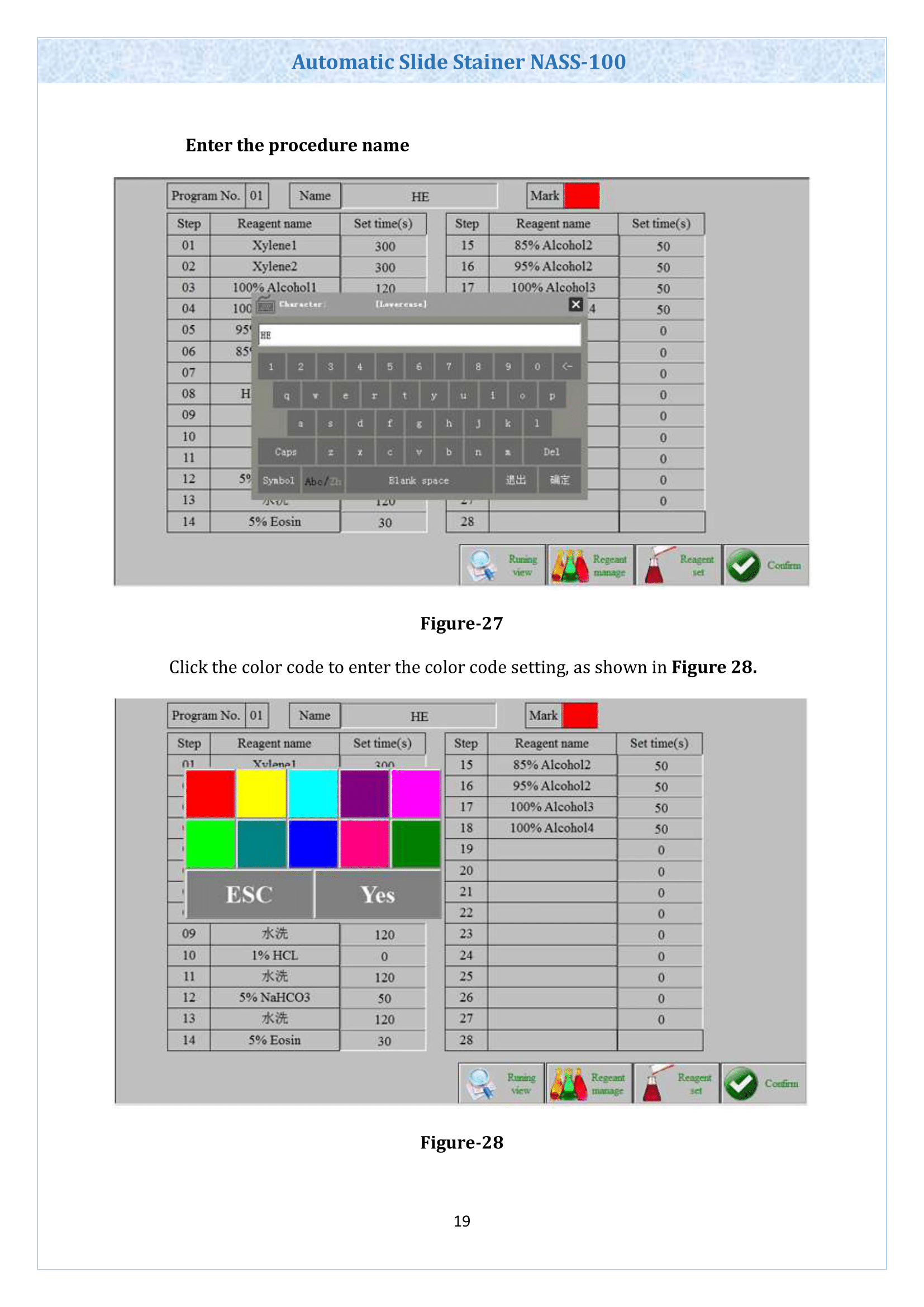 automatic-slide-stainer-nass100-20.png